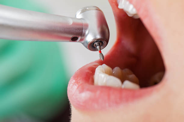 Best Broken or Cracked Tooth Emergency Dentist in Pembroke, GA